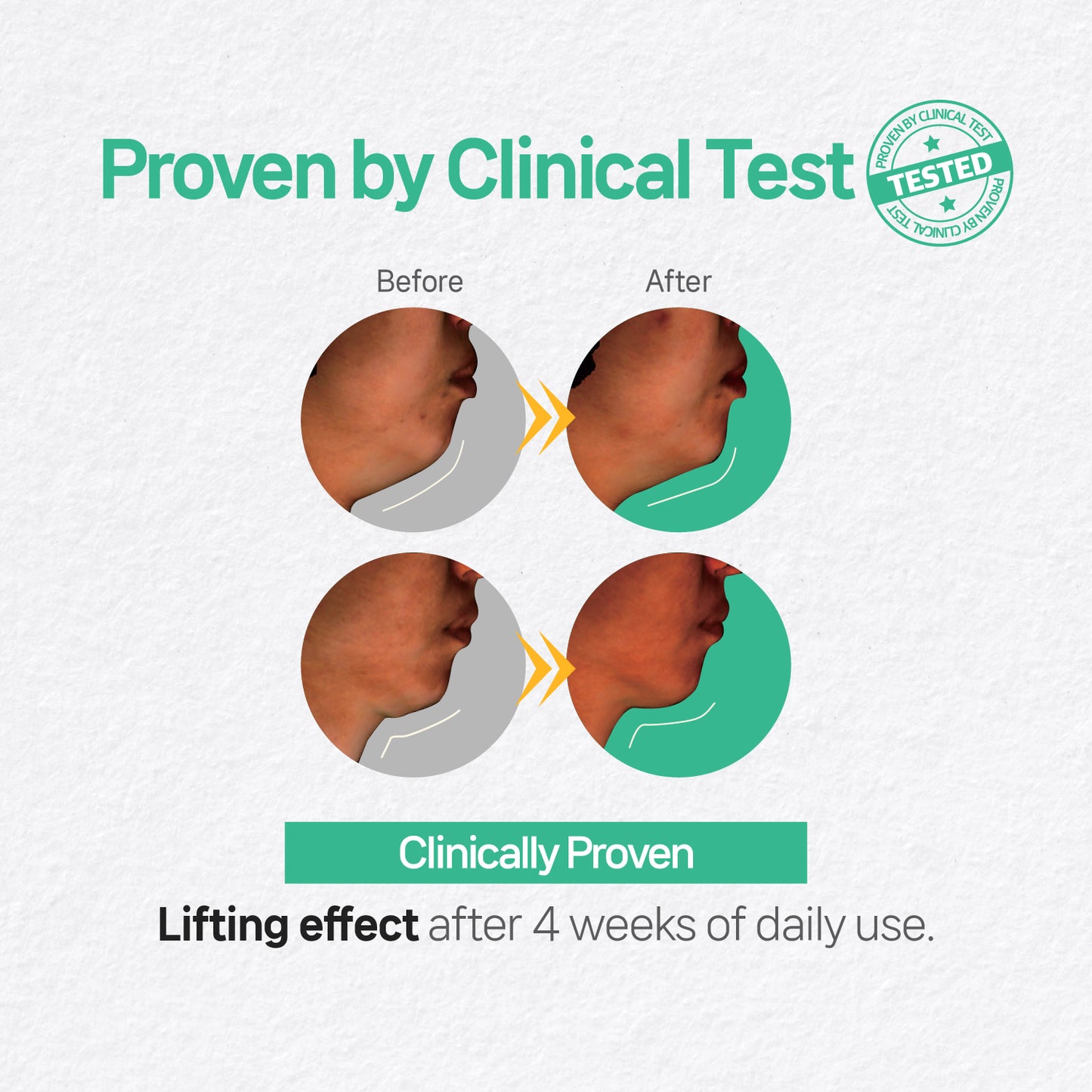 Neck & Chin Patch - 4 Patches