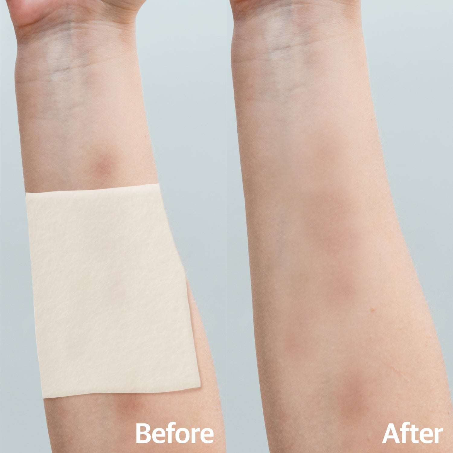 Arni patch for Pain, Bruise, Swelling (1 Pack of 5 Patches) - Laboflex -