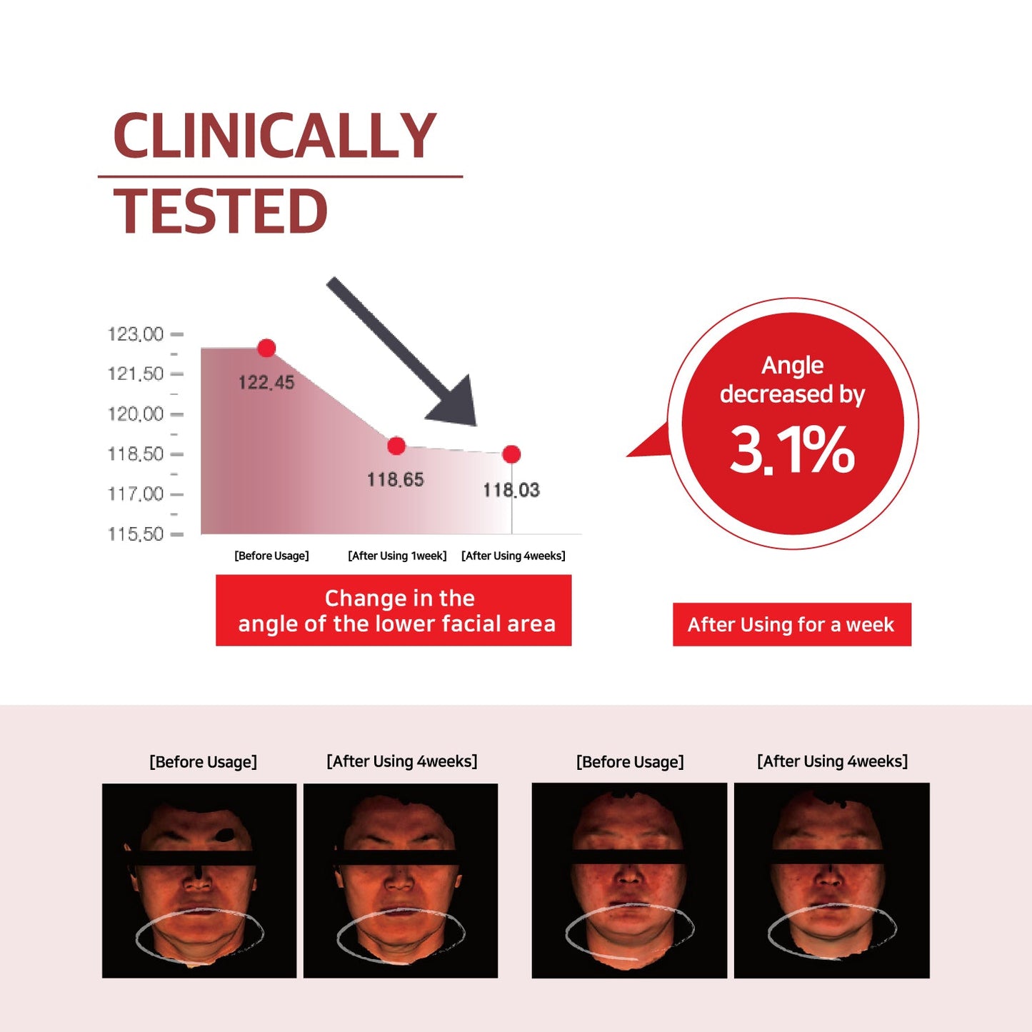 Labottach 4pcs V Line mask Patches, Double Chin Shaping, Face lifting straps band for sleeping for 8hours, Double chin reducer Strap Slimming with Green Tea, Ceramide, Olive, Jojoba, Hyaluronic Acid - Laboflex - 8809409182360