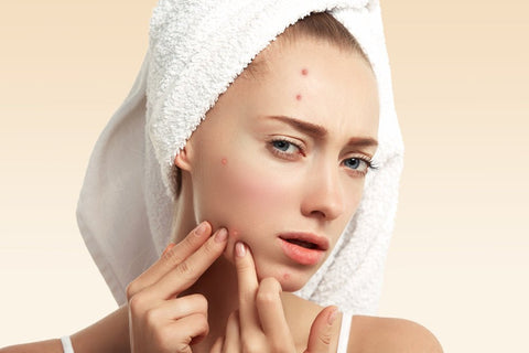 Harness the Power of Tea Tree Oil: Your Ultimate Guide to Banishing Pimples - Laboflex