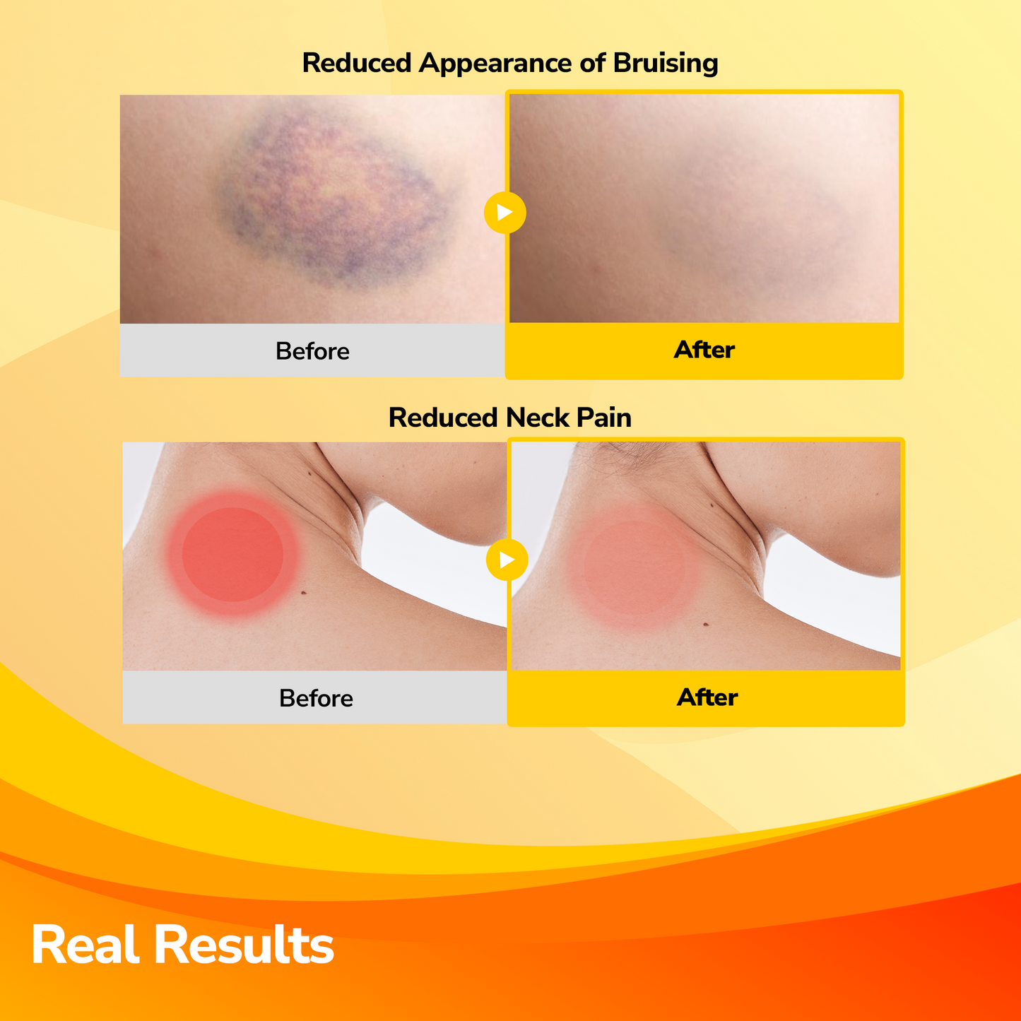 ArniPatch™ Natural Care for Pain, Bruises & Swelling (Renewed Version)