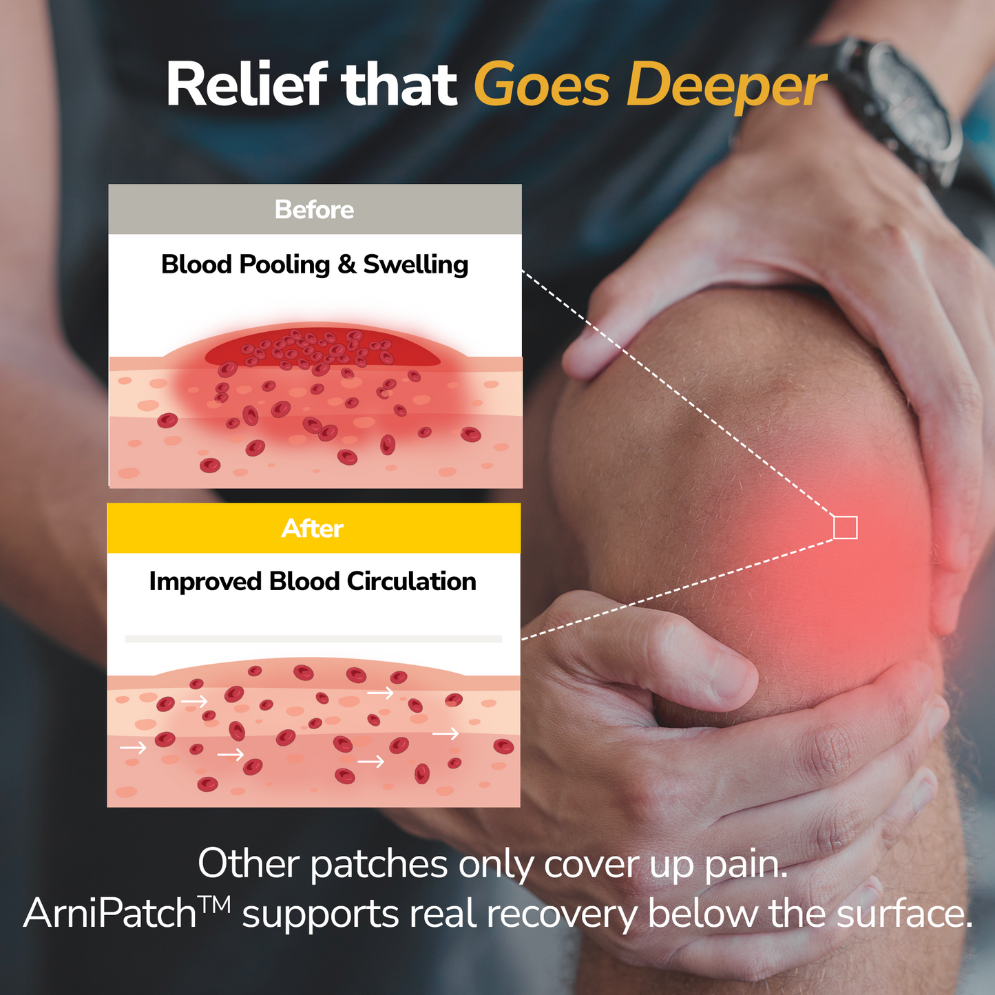 LaboFlex ArniPatch™ Arnica Hydrogel Pain Relief Patches (Renewed Version)