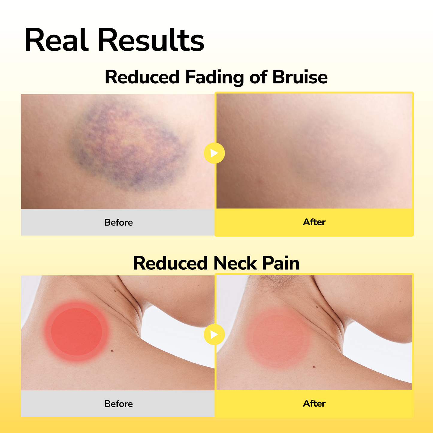 ArniPatch Recovery Bundle