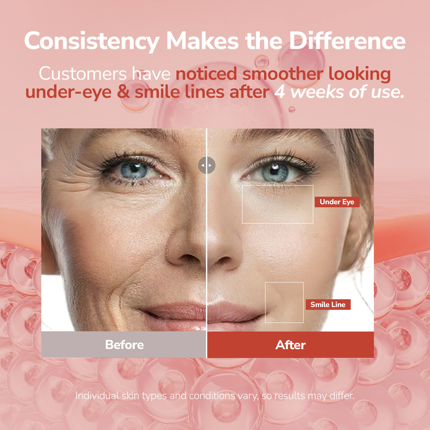 Labottach Cheek AG Patch - 4 Pairs