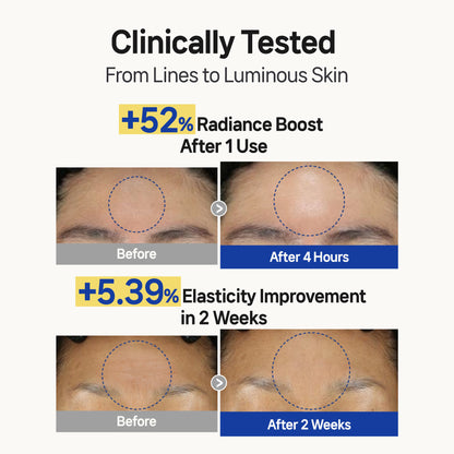 T-Zone AG Forehead Wrinkle Patches - 12 Patches